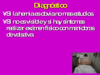 Diagnóstico Si la hernia es obvia no mas estudios.  Si no es visible y si hay síntomas realizar exámen físico con maniobras de valsalva. 