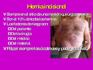 Hernia incisional Siempre en el sitio de una incisión quirúrgica previa. Son el 10% de todas las hernias.  Los factores de riesgo son: Del paciente. De la cirugía. Del médico Del material. Palpar siempre las cicatrices y pedir valsalva. 