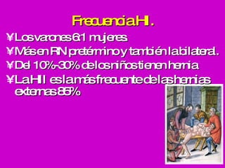 Frecuencia HI . Los varones 6:1 mujeres. Más en RN pretérmino y también la bilateral. Del 10%-30% de los niños tienen hernia  La HII es la más frecuente de las hernias externas 85% 