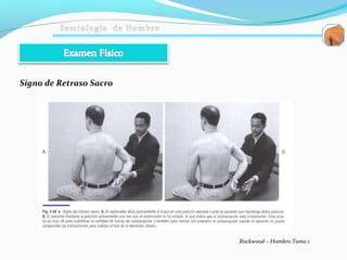 Signo de Retraso Sacro
Rockwood – Hombro Tomo 1
 