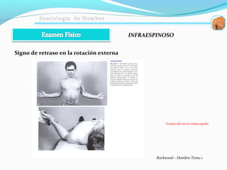 INFRAESPINOSO
Signo de retraso en la rotación externa
Rockwood – Hombro Tomo 1
*Lesión del nervio subescapular
 