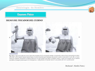 SIGNO DEL TOCADOR DEL CUERNO
Rockwood – Hombro Tomo 1
 