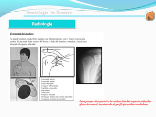 Esta proyección permite la evaluación del espacio articular
gleno-humeral, mostrando el perfil glenoideo verdadero.
 