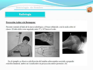 Semiologia de hombro