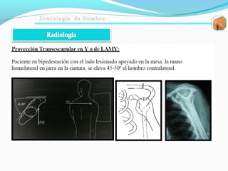Semiologia de hombro