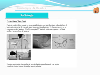 Semiologia de hombro