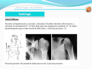 Semiologia de hombro