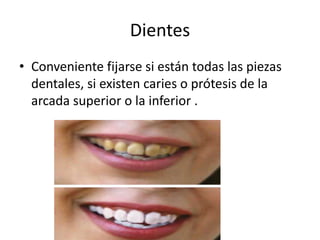 Dientes
• Conveniente fijarse si están todas las piezas
dentales, si existen caries o prótesis de la
arcada superior o la inferior .
 