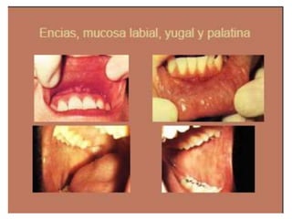 Semiologia de la Cabeza