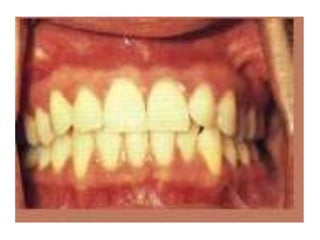 Semiologia de la Cabeza