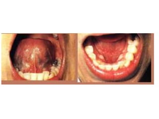 Semiologia de la Cabeza