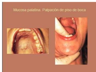 Semiologia de la Cabeza