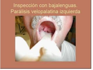 Semiologia de la Cabeza