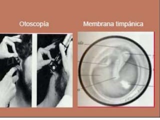 Semiologia de la Cabeza