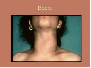 Semiologia de la Cabeza