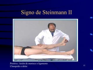 Signo de Steinmann II
13
Positiva : lesión de menisco o ligamento
Chasquido o dolor
 