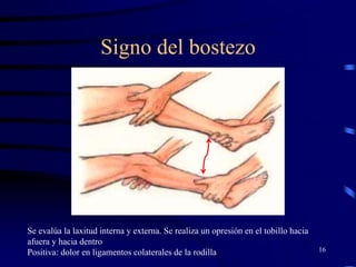 Signo del bostezo
16
Se evalúa la laxitud interna y externa. Se realiza un opresión en el tobillo hacia
afuera y hacia dentro
Positiva: dolor en ligamentos colaterales de la rodilla
 