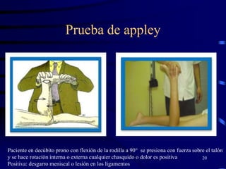 Prueba de appley
20
Paciente en decúbito prono con flexión de la rodilla a 90° se presiona con fuerza sobre el talón
y se hace rotación interna o externa cualquier chasquido o dolor es positiva
Positiva: desgarro meniscal o lesión en los ligamentos
 