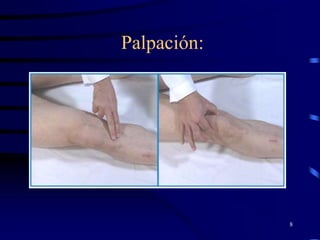 Semiologia de la rodilla