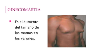 GINECOMASTIA
 Es el aumento
del tamaño de
las mamas en
los varones.
 