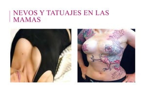NEVOS Y TATUAJES EN LAS
MAMAS
 
