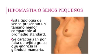 HIPOMASTIA O SENOS PEQUEÑOS
Esta tipología de
senos presentan un
tamaño menor
comparable al
promedio standard.
Se caracterizan por
falta de tejido graso
que engrosa la
glándula mamaria.
 