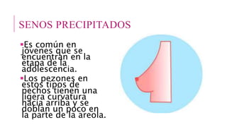 SENOS PRECIPITADOS
Es común en
jóvenes que se
encuentran en la
etapa de la
adolescencia.
Los pezones en
estos tipos de
pechos tienen una
ligera curvatura
hacia arriba y se
doblan un poco en
la parte de la areola.
 