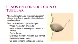 SENOS EN CONSTRICCIÓN O
TUBULAR
Se los llama también “mamas tuberosas”
debido a su forma característica, similar a
una berenjena.
Las características típicas incluyen:
•Areola hinchada y ampliada
•Inusualmente amplio espacio entre los
pechos
•Pecho flacido
•El pliegue mamario mas alto que normal
•Tejido Mínimo de mama
•De base estrecha en la pared torácica
 