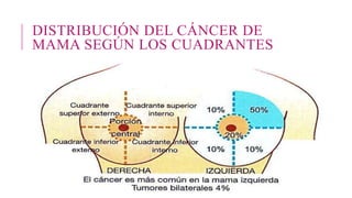 DISTRIBUCIÓN DEL CÁNCER DE
MAMA SEGÚN LOS CUADRANTES
 