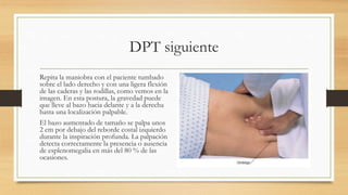 DPT siguiente
Repita la maniobra con el paciente tumbado
sobre el lado derecho y con una ligera flexión
de las caderas y las rodillas, como vemos en la
imagen. En esta postura, la gravedad puede
que lleve al bazo hacia delante y a la derecha
hasta una localización palpable.
El bazo aumentado de tamaño se palpa unos
2 cm por debajo del reborde costal izquierdo
durante la inspiración profunda. La palpación
detecta correctamente la presencia o ausencia
de esplenomegalia en más del 80 % de las
ocasiones.
 