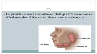  Las glándulas salivales submaxilares afectadas por inflamación crónica
dificultan también el Diagnostico diferencial con una adenopatía.
 