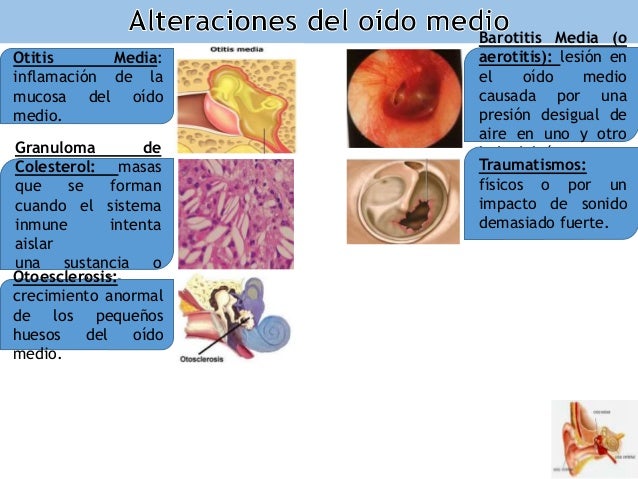 De que duele el cuello con el lado