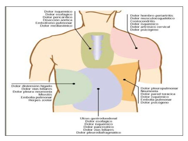 Que ungüento aplican a la osteocondrosis