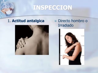 INSPECCION
1. Actitud antalgica  Directo hombro o
Irradiado
 