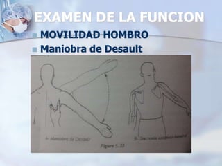 EXAMEN DE LA FUNCION
 MOVILIDAD HOMBRO
 Maniobra de Desault
 
