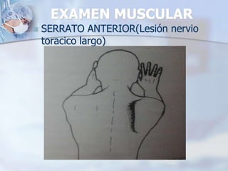 EXAMEN MUSCULAR
 SERRATO ANTERIOR(Lesión nervio
toracico largo)
 