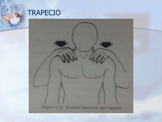  TRAPECIO
 