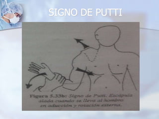 SIGNO DE PUTTI
 