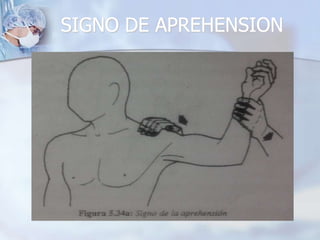 SIGNO DE APREHENSION
 
