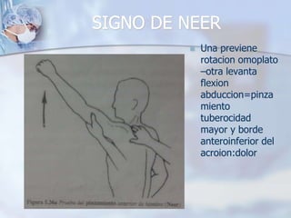 SIGNO DE NEER
 Signo de
pinzamiento
anterior
 Una previene
rotacion omoplato
–otra levanta
flexion
abduccion=pinza
miento
tuberocidad
mayor y borde
anteroinferior del
acroion:dolor
 