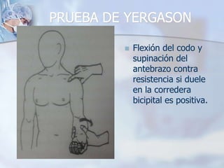 PRUEBA DE YERGASON
 Flexión del codo y
supinación del
antebrazo contra
resistencia si duele
en la corredera
bicipital es positiva.
 