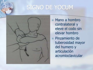 SIGNO DE YOCUM
 Mano a hombro
contralateral y
eleve el codo sin
elevar hombro
 Pinzamiento de
tuberosidad mayor
del humero y
articulación
acromioclavicular
 