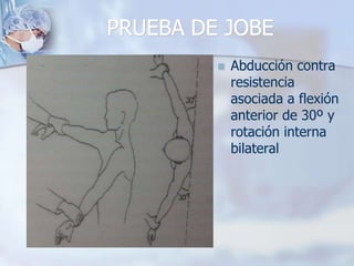 PRUEBA DE JOBE
 Abducción contra
resistencia
asociada a flexión
anterior de 30º y
rotación interna
bilateral
 