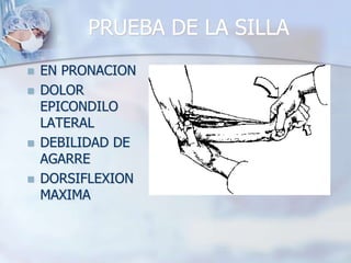 PRUEBA DE LA SILLA
 EN PRONACION
 DOLOR
EPICONDILO
LATERAL
 DEBILIDAD DE
AGARRE
 DORSIFLEXION
MAXIMA
 