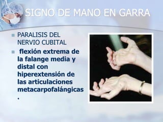 SIGNO DE MANO EN GARRA
 PARALISIS DEL
NERVIO CUBITAL
 flexión extrema de
la falange media y
distal con
hiperextensión de
las articulaciones
metacarpofalángicas
.
 