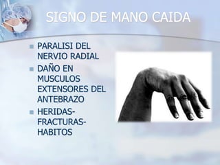 SIGNO DE MANO CAIDA
 PARALISI DEL
NERVIO RADIAL
 DAÑO EN
MUSCULOS
EXTENSORES DEL
ANTEBRAZO
 HERIDAS-
FRACTURAS-
HABITOS
 