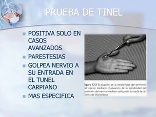 PRUEBA DE TINEL
 POSITIVA SOLO EN
CASOS
AVANZADOS
 PARESTESIAS
 GOLPEA NERVIO A
SU ENTRADA EN
EL TUNEL
CARPIANO
 MAS ESPECIFICA
 
