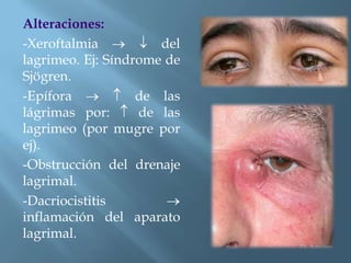 Alteraciones:
-Xeroftalmia          del
lagrimeo. Ej: Síndrome de
Sjögren.
-Epífora           de las
lágrimas por:      de las
lagrimeo (por mugre por
ej).
-Obstrucción del drenaje
lagrimal.
-Dacriocistitis
inflamación del aparato
lagrimal.
 