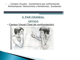 Semiologia Del Ojo Exploracion Semiologica De II III IV Y VI Par Semiologia Del Ojo Exploracion Semiologica De II III IV Y VI Par