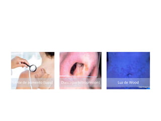 SEMIOLOGIA DERMATOLOGICA.pptx